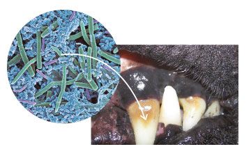 Tartar under a microscope
